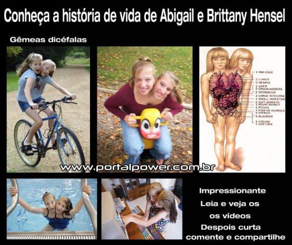 Abigail e Brittany Hensel