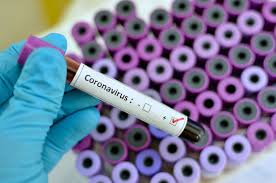 Coronavirus covid 19 22